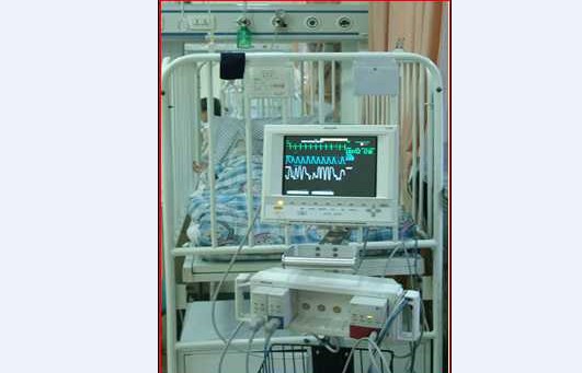 皮肤科病房监护设备